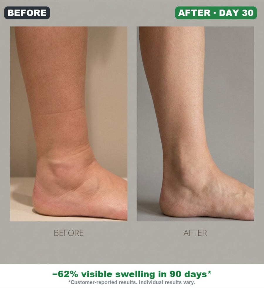 Before and after — swelling