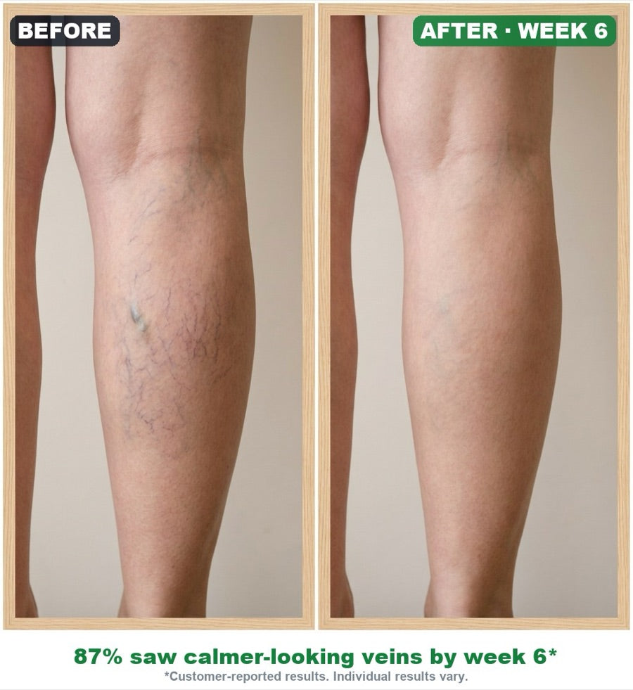 Before and after — veins